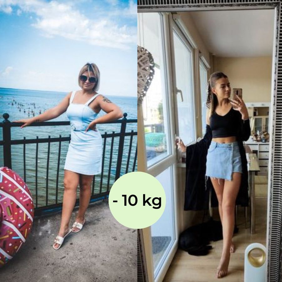 Metamorfoza Pacjenta Centrum Dietetyki i Aktywności — −10 kg