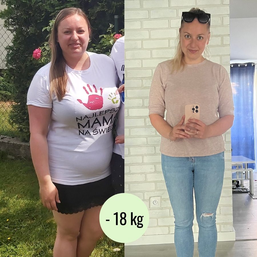 Metamorfoza pacjentki — minus 18 kg