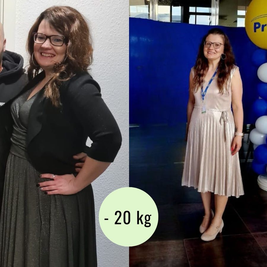 Metamorfoza Pacjenta Centrum Dietetyki i Aktywności — −20 kg