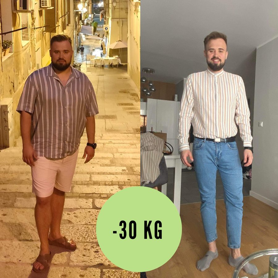 Metamorfoza pacjenta — minus 30 kg