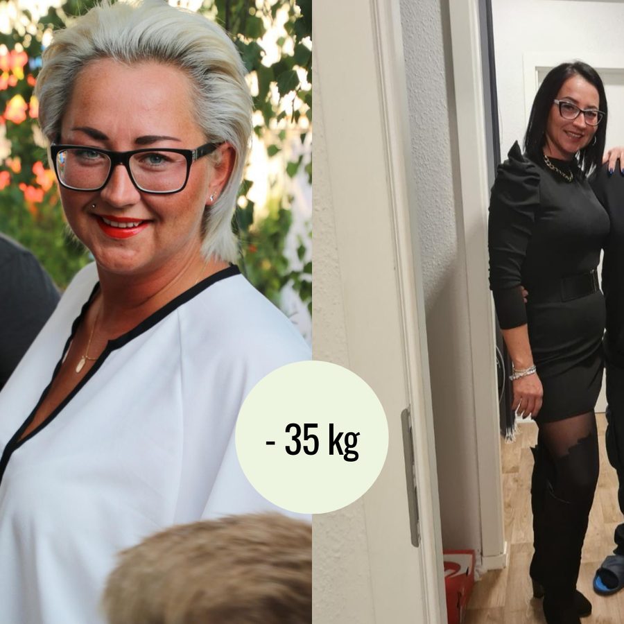 Metamorfoza pacjentki — minus 35 kg