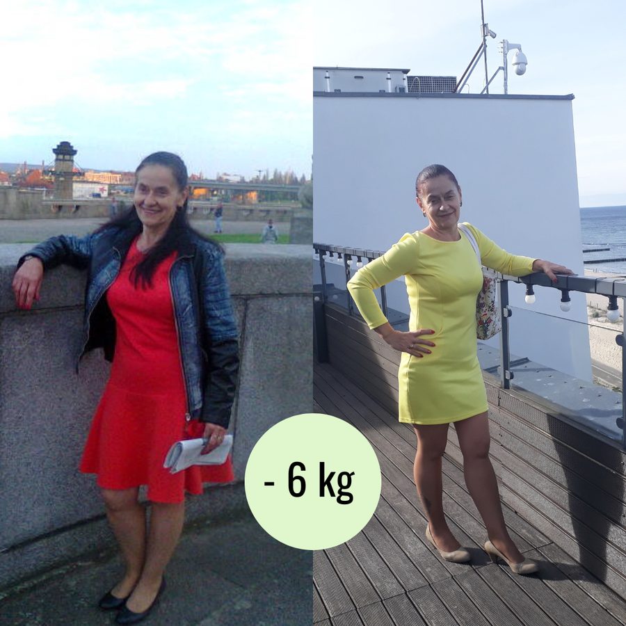 Metamorfoza Pacjenta Centrum Dietetyki i Aktywności — −6 kg
